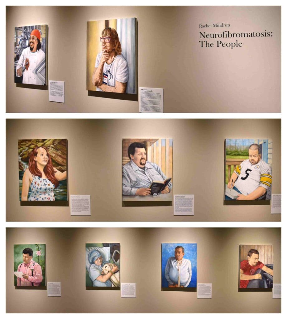 An exhibit on neurofibromatosis brings real life to bear in art.